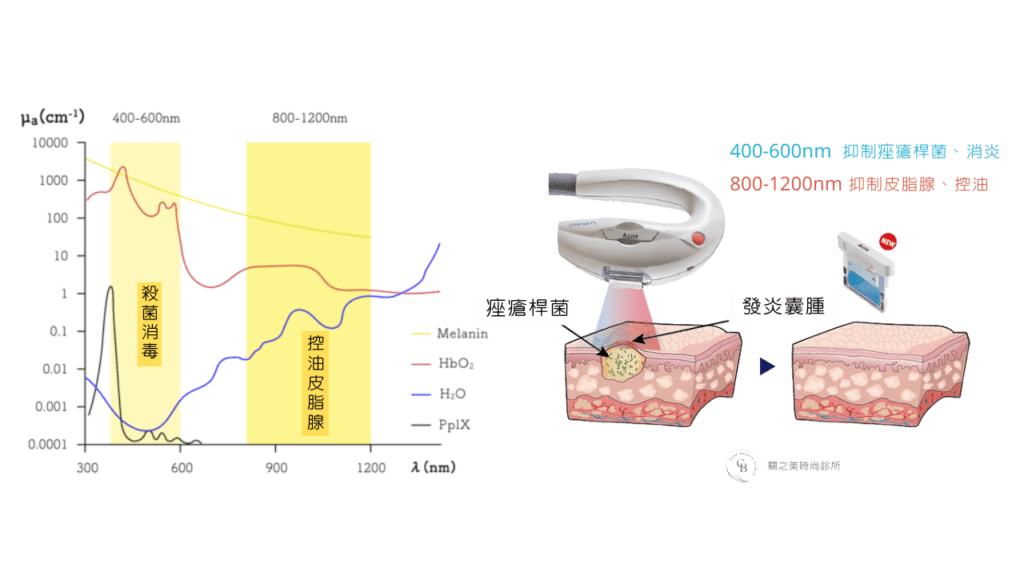 「Acne 雙波淨痘濾鏡」運用400-600/800-1200 nm的寬光譜和雙波長能量,針對痘痘問題進行治療,其中短波段的藍光有助於抑制痤瘡桿菌的生長,而紅色和紅外光波段則能調節皮脂分泌,同時舒緩發炎現象。