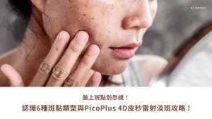 臉上斑點別忽視！ 認識6種斑點類型與PicoPlus 4D皮秒雷射淡斑攻略
