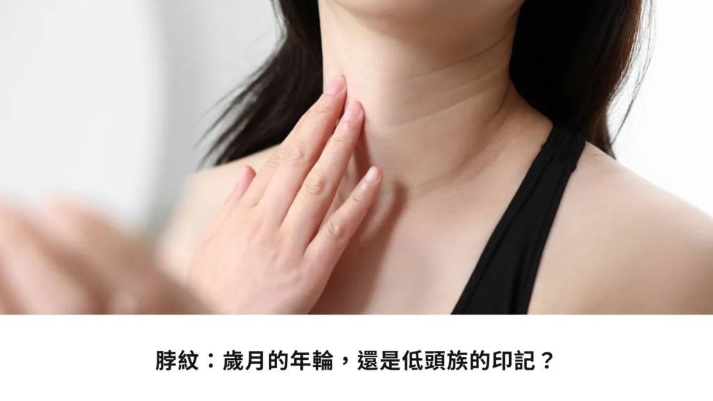 脖紋歲月的年輪還是低頭族的印記